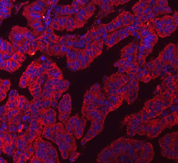 Anti-Claudin 3/CLDN3 Antibody (monoclonal, 4C7D2)
