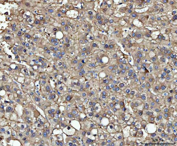 Anti-ME1 Antibody (monoclonal, 5E5F7)