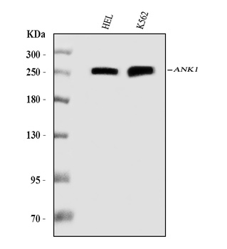 Ankyrin erythroid/ANK/ANK1 Antibody (monoclonal, 5H2E8)