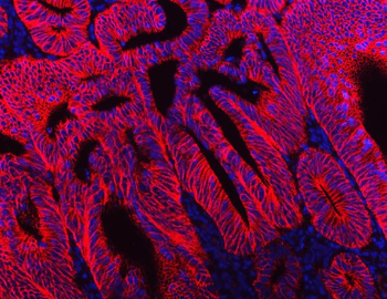 Anti-NKCC1/SLC12A2 Antibody (monoclonal, 6G7D2)