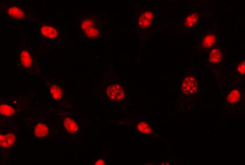 Anti-AREB6/ZEB1 Antibody (monoclonal, 8B12D7)