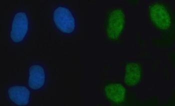 RAMP/ZMYM2 Antibody
