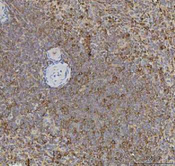 Anti-CCXCR1/XCR1 Antibody