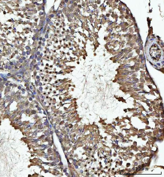 Anti-USP26 Antibody