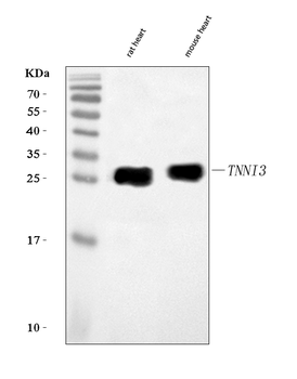 Anti-Cardiac Troponin I/TNNI3 Antibody