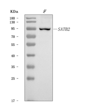 Anti-SATB2 Antibody