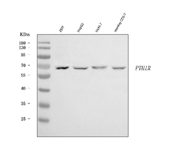 Parathyroid Hormone Receptor 1/PTH1R Antibody