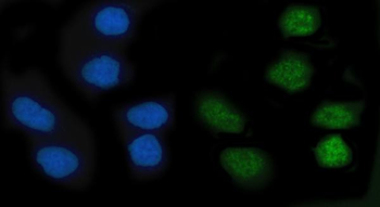 Anti-KLF10 Antibody