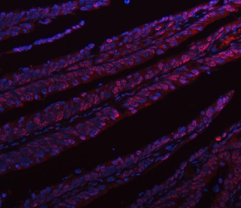 Anti-hnRNP L/HNRNPL Antibody