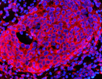 Anti-HMGCR Antibody