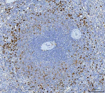 Anti-Granzyme K/GZMK Antibody