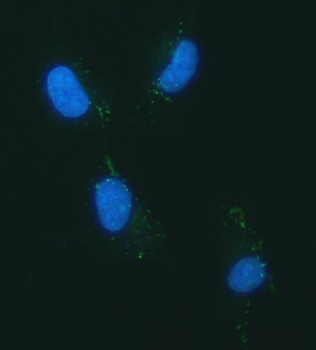 Anti-YKL-40/CHI3L1 Antibody