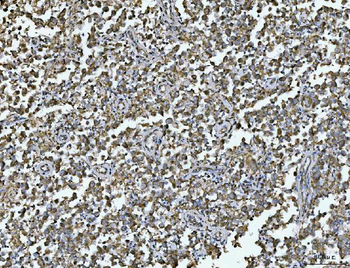 Anti-ARL13B Antibody