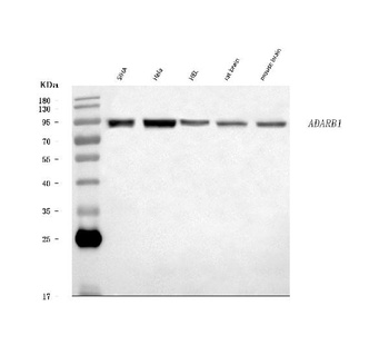 RED1/ADARB1 Antibody