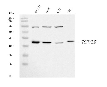 TSPYL5 Antibody