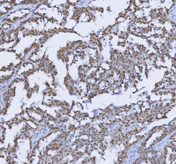 Anti-TRMT6 Antibody