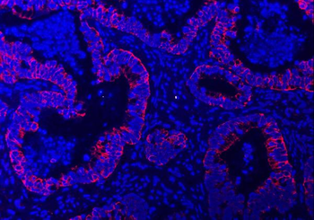 Anti-TRAM1L1 Antibody