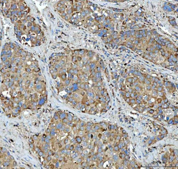 Anti-Tripeptidyl peptidase II/TPPII/TPP2 Antibody
