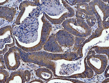 Anti-SIRT5 Antibody