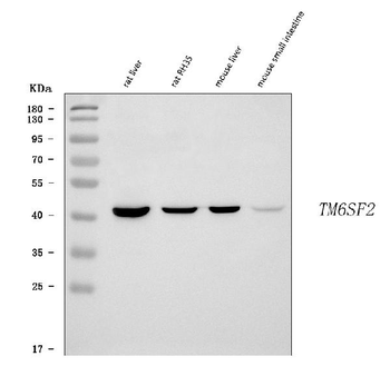 Anti-TM6SF2 Antibody