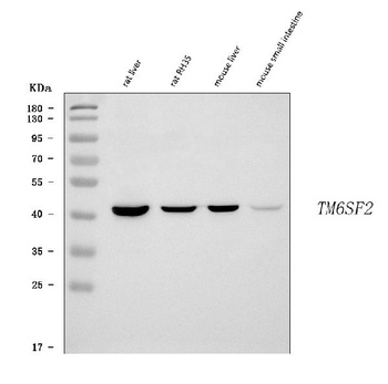TM6SF2 Antibody