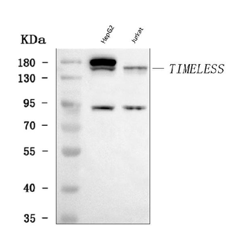 Anti-TIMELESS Antibody