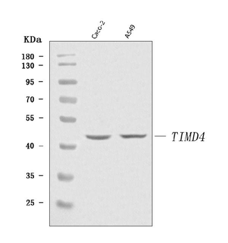 Anti-TIM 4/TIMD4 Antibody