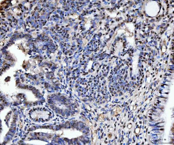 Anti-TIGD1 Antibody