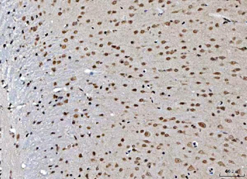Anti-THAP11 Antibody