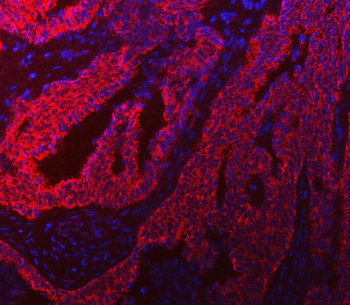 Anti-TRK fused gene/TFG Antibody