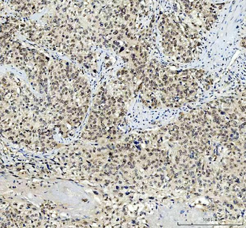 Anti-TBX18 Antibody