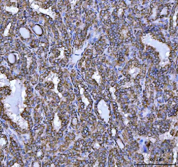 Anti-NDUFS5 Antibody
