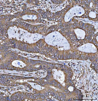 Anti-HSD17B7 Antibody