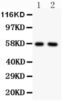 Alkaline Phosphatase/ALPL Antibody