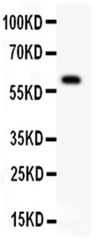 Anti-DR3/TNFRSF25 Antibody