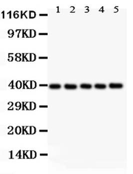 Anti-Bonzo/CXCR6 Antibody