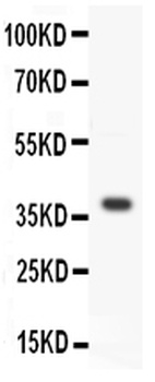 Protein Wnt-3a Wnt3a Antibody