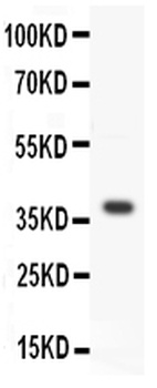 Anti-Protein Wnt-3a Wnt3a Antibody