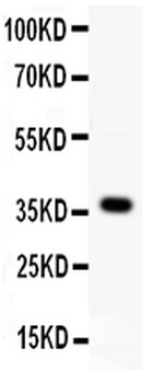Protein Wnt-4 Wnt4 Antibody