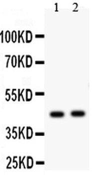 Transcription factor E2F4 E2F4 Antibody