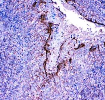 Anti-Profilin 2/PFN2 Antibody