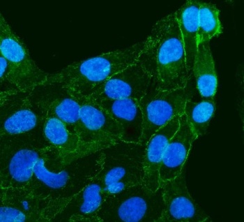 Anti-gamma Catenin/JUP Antibody