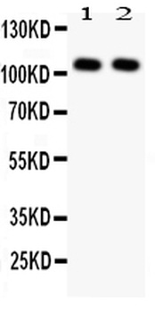 Anti-NFkB/NFKB1 p105/p50 Antibody