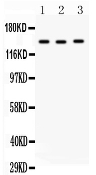 Angiotensin Converting Enzyme 1/ACE Antibody