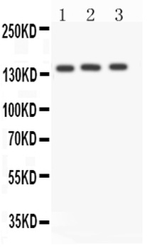 Anti-Angiotensin Converting Enzyme 1/ACE Antibody