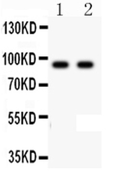 Anti-LI-Cadherin-17 CDH17-Antibody
