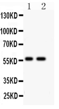 E3 SUMO-protein ligase PIAS4 Antibody