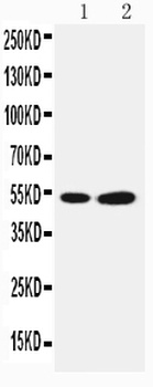 Anti-SBP/SELENBP1 Antibody