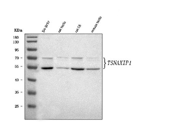TSNAXIP1 Antibody