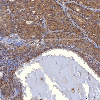 Anti-PIG3/TP53I3 Antibody